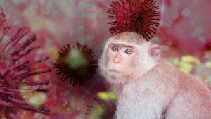 Symptoms of Monkeypox Virus Infection