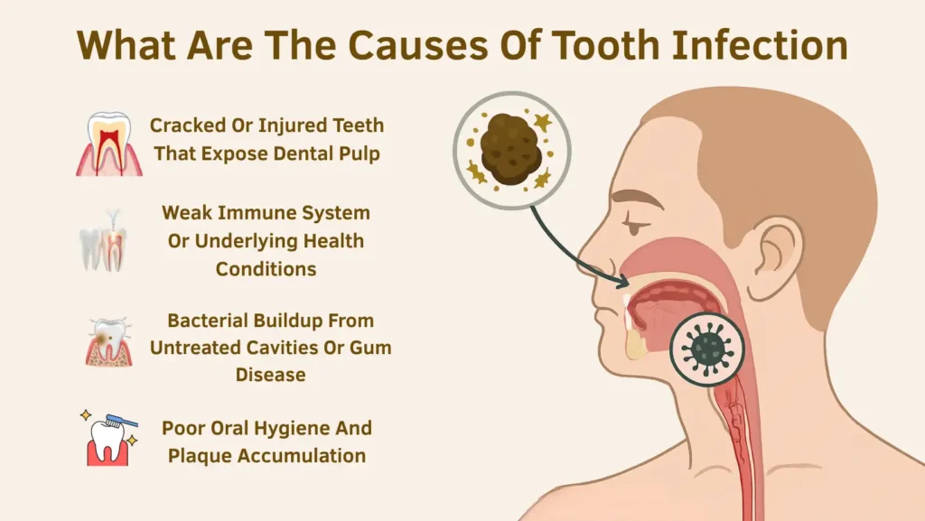 What Are the Causes of Tooth Infection
