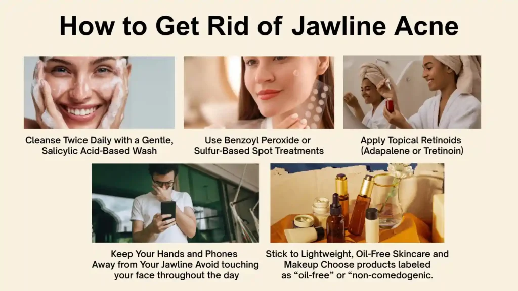 how to get rid of jawline acne naturally