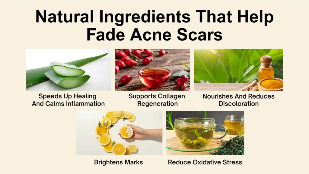 how to get rid of acne scars​ naturally