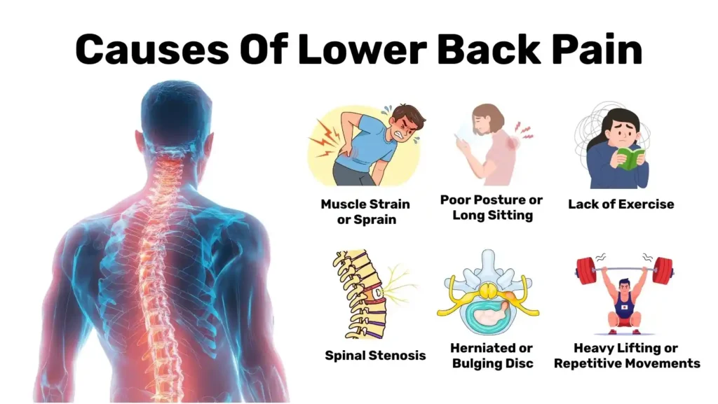 Main Causes Of Lower Back Pain