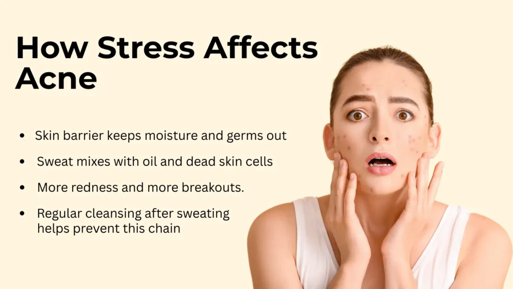 How Stress Affects Acne