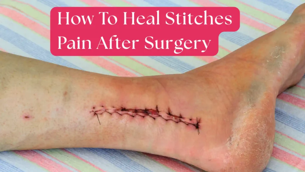 Stitches Pain After Surgery
