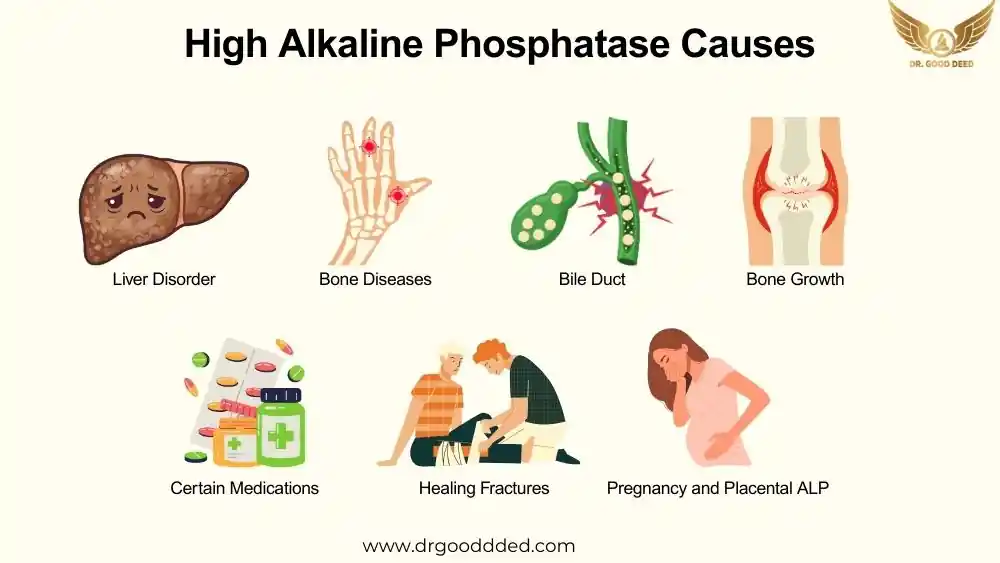 High Alkaline Phosphatase Causes