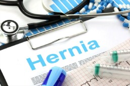 4 Best Exercises For Hernia Patients - Dr Good Deeds