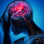 Neurological Symptoms in Hypertension: What You Need to Know