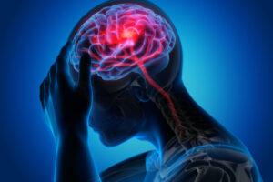 Neurological Symptoms in Hypertension: What You Need to Know