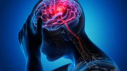 neurological symptom