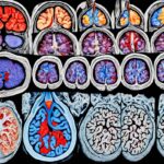 Understanding Adult Brain Tumor Types