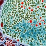 UTI Management in Diabetic Patients