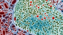 urinary tract infection in diabetic patients