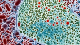 urinary tract infection in diabetic patients