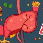 The Impact of High Fat Diets on Liver Health