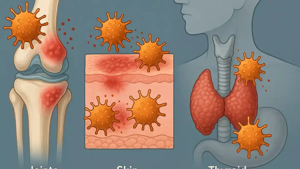 Autoimmune Diseases Explained: Types, Symptoms, and Treatments