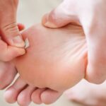 Warts Be Gone Remover! Natural Cures That Really Work