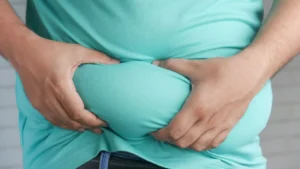 Obesity vs Overweight – What’s the Difference?