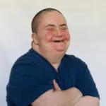 What’s the Link Between Down Syndrome and Obesity?