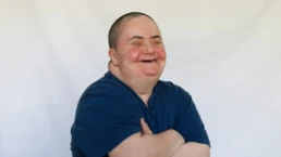 down syndrome and obesity