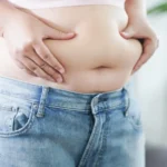 Medical Myths: 5 Common Misconceptions About Obesity