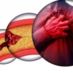 What’s the Link Between Obesity and Heart Disease?