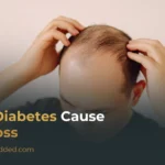 Does Diabetes Cause Hair Loss? Here’s the Science Behind It