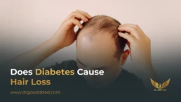 does diabetes cause hair loss