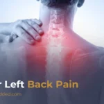 Upper Left Back Pain: Causes, Symptoms, and Effective Treatment Options