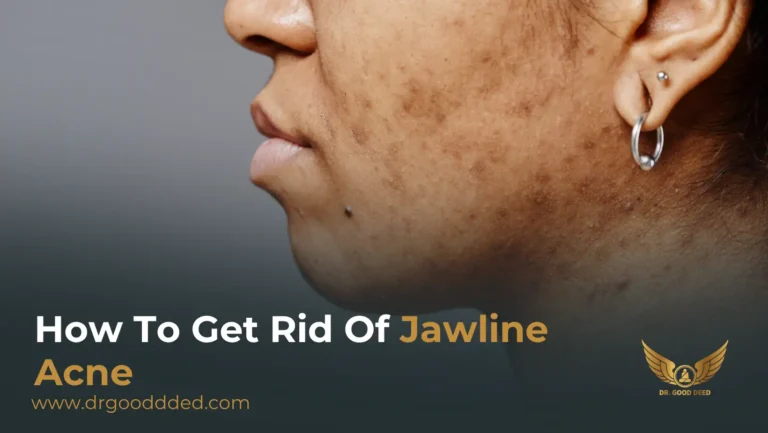 How to Get Rid of Jawline Acne: Expert-Approved Causes, Treatments & Prevention