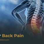 Lower Back Pain: Causes, Symptoms, and Effective Treatment Options