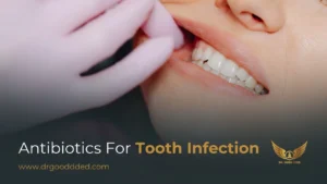 Antibiotics for Tooth Infection: Best Treatments, Natural Alternatives, and When to See a Dentist