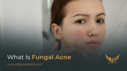 what is fungal acne