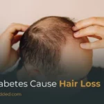 Can Diabetes Cause Hair Loss? Understanding The Link Between Blood Sugar And Hair Thinning
