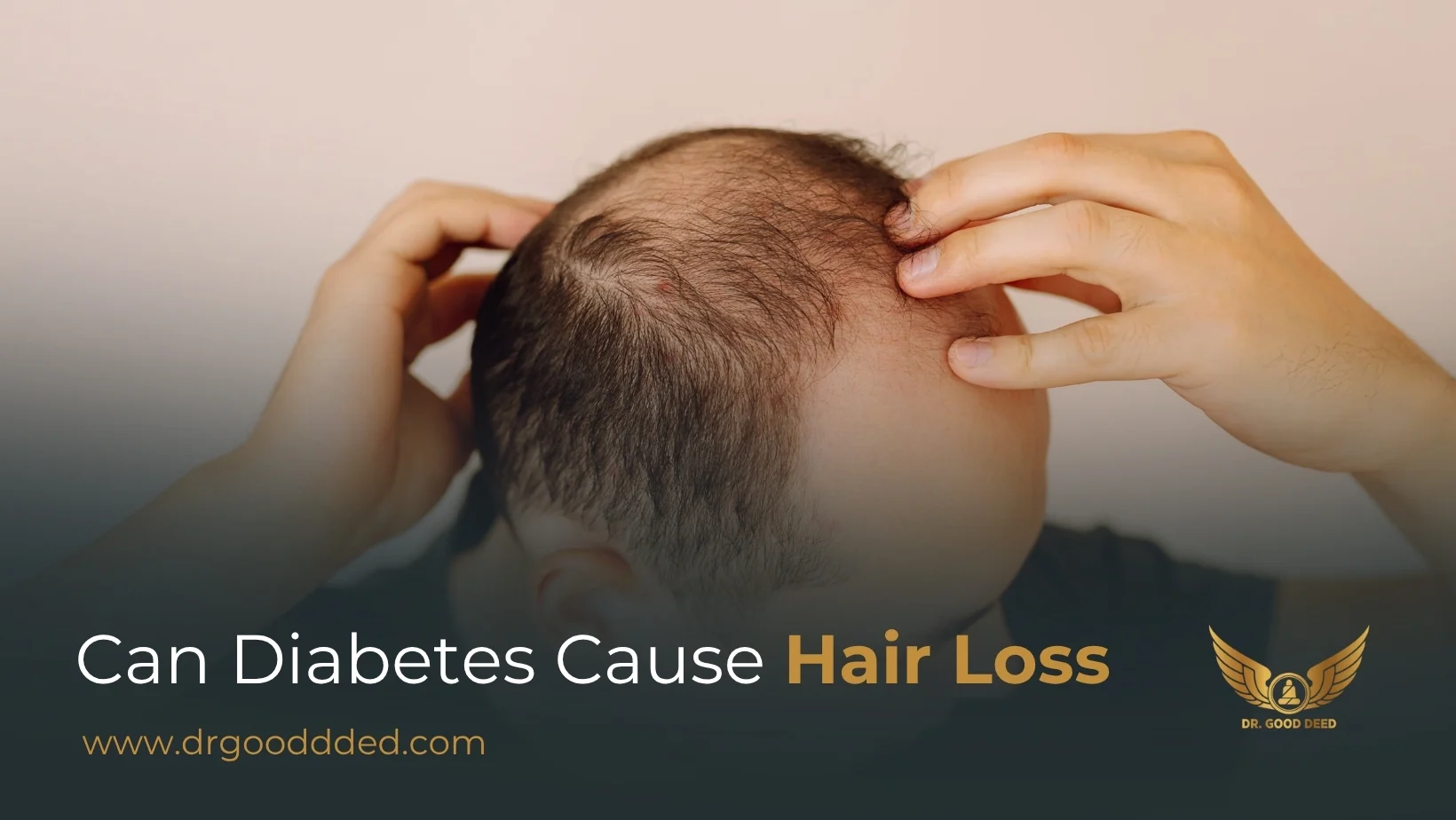Can Diabetes Cause Hair Loss? Understanding The Link Between Blood Sugar And Hair Thinning