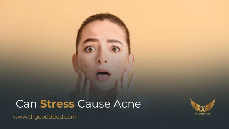 Can Stress Cause Acne? Symptoms, Causes, and Treatment