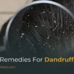 Home Remedies for Dandruff: Natural Ways to Treat a Flaky Scalp