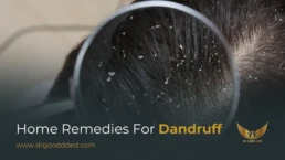 home remedies for dandruff​