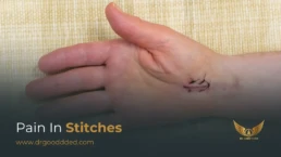 Pain In Stitches