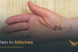 Pain In Stitches