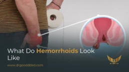 what do hemorrhoids look like