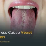 Can Stress Cause A Yeast Infection? Causes, Symptoms & Prevention Guide