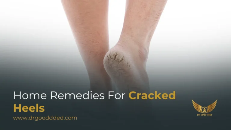 Home Remedies For Cracked Heels: Complete Guide