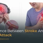 Difference Between Stroke and Heart Attack: Causes, Symptoms & Treatment