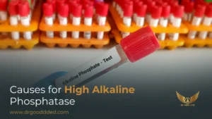 High Alkaline Phosphatase Levels: Causes You Should Not Ignore