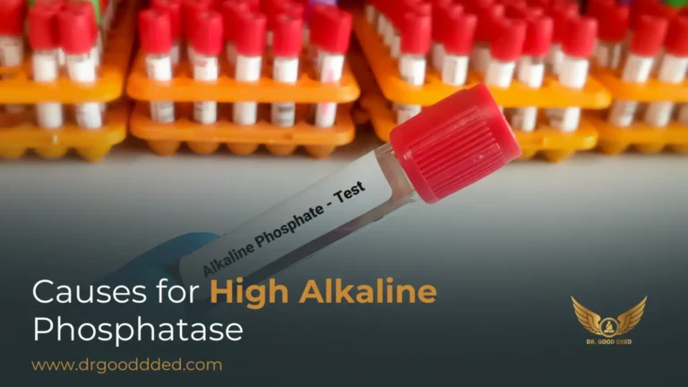 High Alkaline Phosphatase