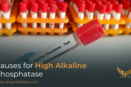High Alkaline Phosphatase