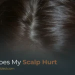 Why Does My Scalp Hurt? Causes, Symptoms, and Relief