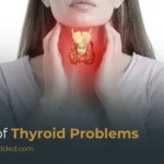 Signs of Thyroid Problems: 15 Common Signs You Should Not Ignore