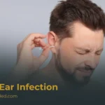 What Is a Fungal Ear Infection (Otomycosis)? Symptoms and Treatment
