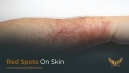 red spots on skin