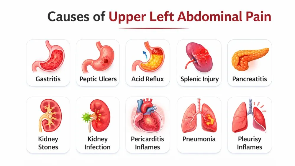 Causes of Upper Left Abdominal Pain